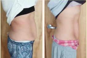 Side-by-side midsection comparison